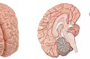 Brain with Arteries 2 Parts Exporter & Educational Laborator