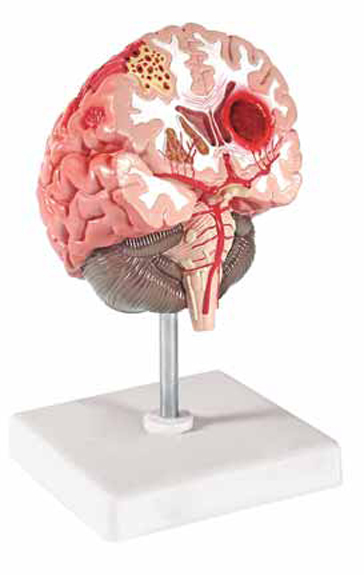 Brain Pathologies Exporter & Educational Laboratory Equipmen