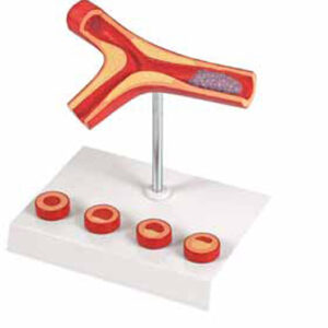 Atherosclerosis and Thrombosis Model Exporter & Educational