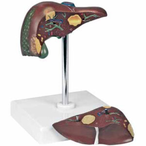 Pathological Model of the Liver Exporter & Educational Labor