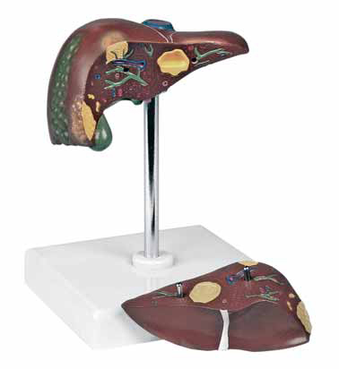 Pathological Model of the Liver Exporter & Educational Labor