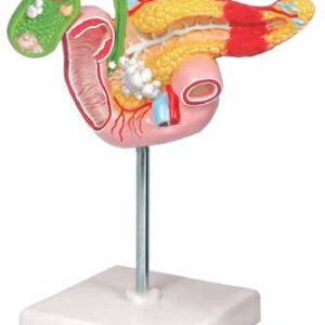 Pathological Model of the Pancreas
