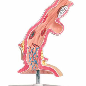 Pathological Model of Esophagus Exporter & Educational Labor