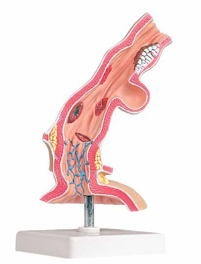 Pathological Model of Esophagus Exporter & Educational Labor