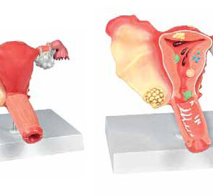 Pathological Model of the Female Reproductive System Exporte