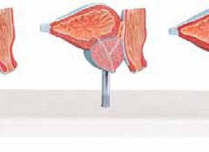 Normal and Diseased Prostate Gland Exporter & Educational La