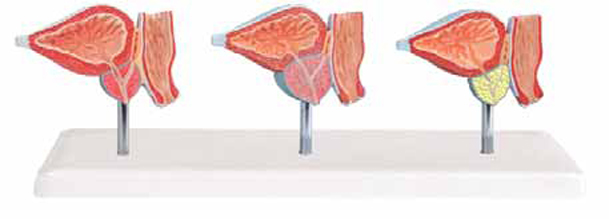 Normal and Diseased Prostate Gland Exporter & Educational La