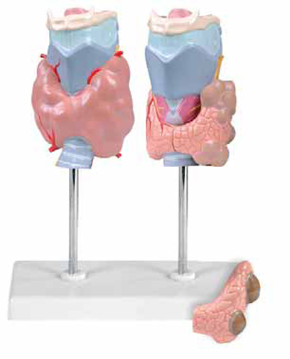 Thyroid Diseases