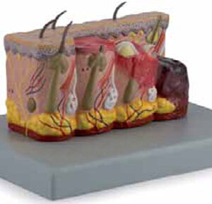 Pathological Model of Burned Skin Exporter & Educational Lab