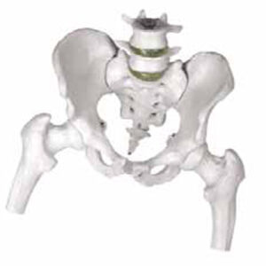 Model of Pelvis with 4th and 5th Lumbar Vertebrae with Femur