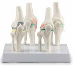 Knee Joints Set Exporter & Educational Laboratory Equipment