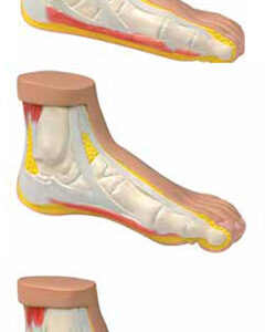 Normal and Abnormal Foot Exporter & Educational Laboratory E