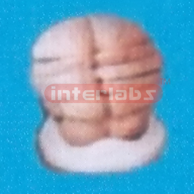 ANATONOMICAL MODEL OF BRAIN
