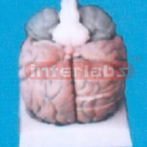 SUPER BRAIN MODEL (12PCS) Manufacturers and Suppliers From Ambala India