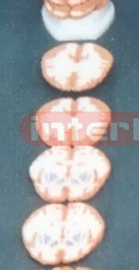 ANATOMICAL MODEL OF BRAIN(TRANSVERSE HORIZONTAL) SECTION Manufacturers and Suppliers From Ambala India