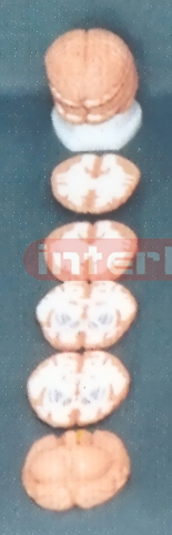 ANATOMICAL MODEL OF BRAIN(TRANSVERSE HORIZONTAL) SECTION Manufacturers and Suppliers From Ambala India