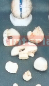 CORONAL BRAIN MODEL (9 PCS) Manufacturers and Suppliers From Ambala India