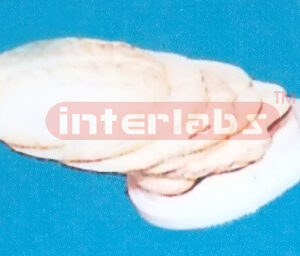 ANATOMICAL MODEL OF BRAIN (TRANSVERSE HORIZONTAL SECTION) Manufacturers and Suppliers From Ambala India