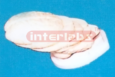 ANATOMICAL MODEL OF BRAIN (TRANSVERSE HORIZONTAL SECTION) Manufacturers and Suppliers From Ambala India