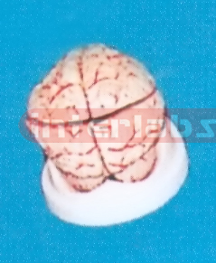WHITE BRAIN ON BASE Manufacturers and Suppliers From Ambala India