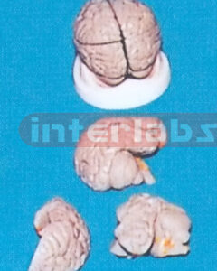 GREY BRAIN ON BASE Manufacturers and Suppliers From Ambala India