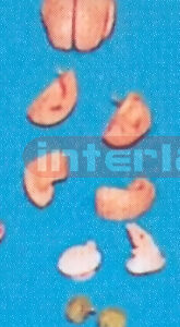 MIDDLE PINKISH BRAIN ON BASE (8 PCS) Manufacturers and Suppliers From Ambala India