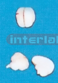 MIDDLE WHITE BRAIN (2PCS) Manufacturers and Suppliers From Ambala India