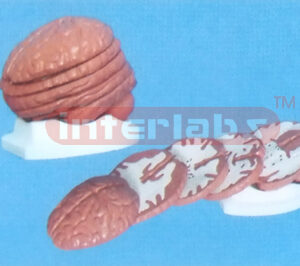 16 x 12.5 x 15 cm TRANSVERSE PLANE SECTION OF BRAIN NUMBERED With BASE (5PCS) Manufacturers and Suppliers From Ambala India