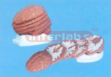 16 x 12.5 x 15 cm TRANSVERSE PLANE SECTION OF BRAIN NUMBERED With BASE (5PCS) Manufacturers and Suppliers From Ambala India
