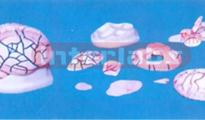 19 x 14 x 14 cm CORONAL BRAIN MODEL (9 PCS) Manufacturers and Suppliers From Ambala India