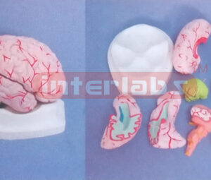 BRIGHT PINKISH BRAIN