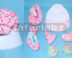 WEST-TYPE BRAIN