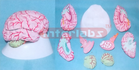 WEST-TYPE BRAIN