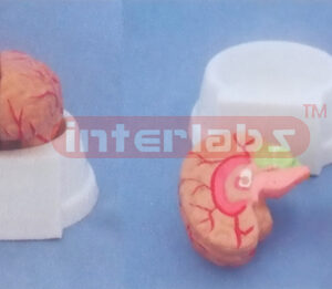 MIDDLE PINKISH BRAIN