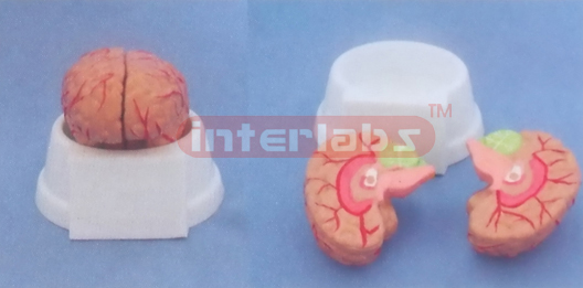 MIDDLE PINKISH BRAIN