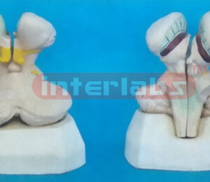 MODEL OF THE PLEXUS CHORDIDEUS VENTRICULI QUARTUS Manufacturers and Suppliers From Ambala India