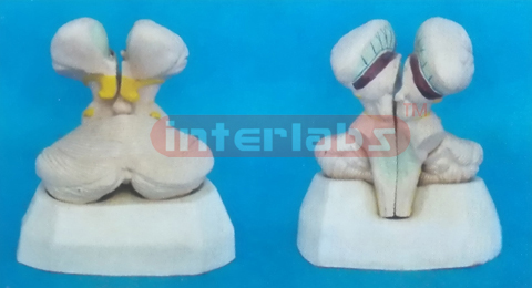 MODEL OF THE PLEXUS CHORDIDEUS VENTRICULI QUARTUS Manufacturers and Suppliers From Ambala India