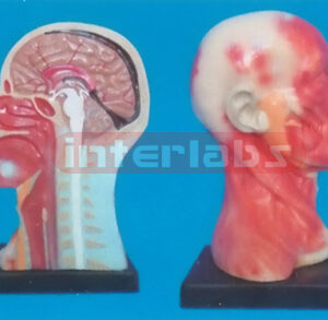 HUMAN HEAD CAVITY AND NECK LOCAL ANATOMY FOR HEAD AND NECK Manufacturers and Suppliers From Ambala India