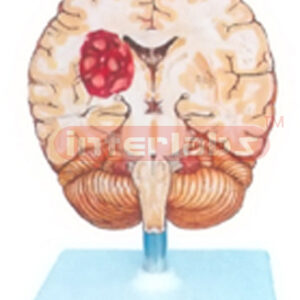 HUMAN BRAIN STROKE MODEL Manufacturers and Suppliers From Ambala India