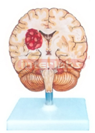 HUMAN BRAIN STROKE MODEL Manufacturers and Suppliers From Ambala India