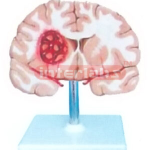 BRAIN MODEL BY SMOKE STROKING AND WIDESCRIPTION PLATE Manufacturers and Suppliers From Ambala India