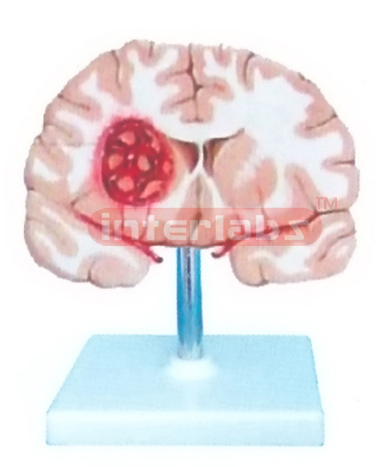 BRAIN MODEL BY SMOKE STROKING AND WIDESCRIPTION PLATE Manufacturers and Suppliers From Ambala India