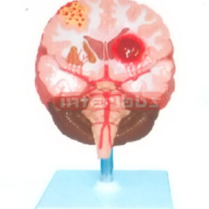 BRAIN STROKE DEMONSTRATION MODEL Manufacturers and Suppliers From Ambala India