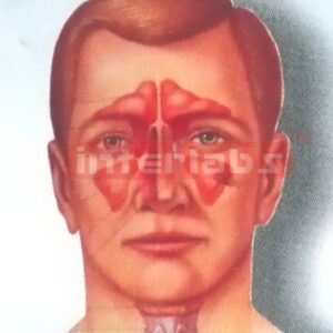 HEAD