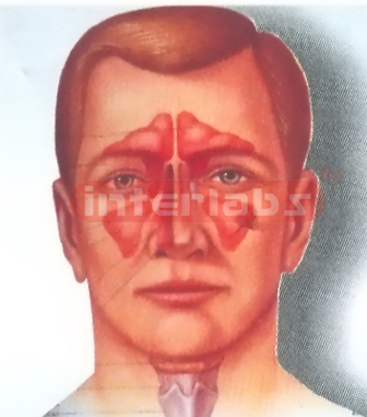HEAD