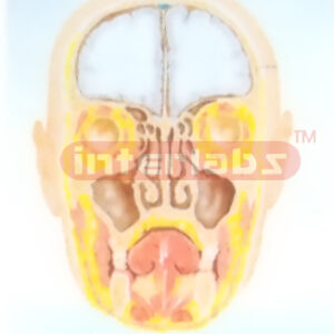 HUMAN PARANASAL SINUSES MODEL Manufacturers and Suppliers From Ambala India