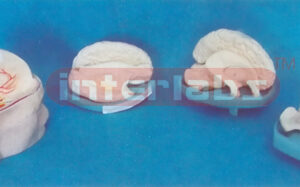 BRAIN MODEL FOR SPECIAL ANATOMICAL SIDE (A SIDE