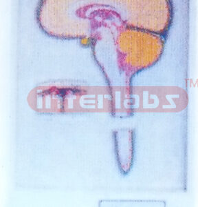 ELECTRIC CONDUCTION OF L1GUOR CEREBROSPINALIS CIRCULATION MODEL Manufacturers and Suppliers From Ambala India
