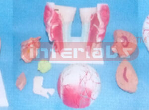BIG HEAD SECTION MODEL Manufacturers and Suppliers From Ambala India
