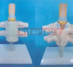 ANATOMICAL SPINE CORD MODEL Manufacturers and Suppliers From Ambala India